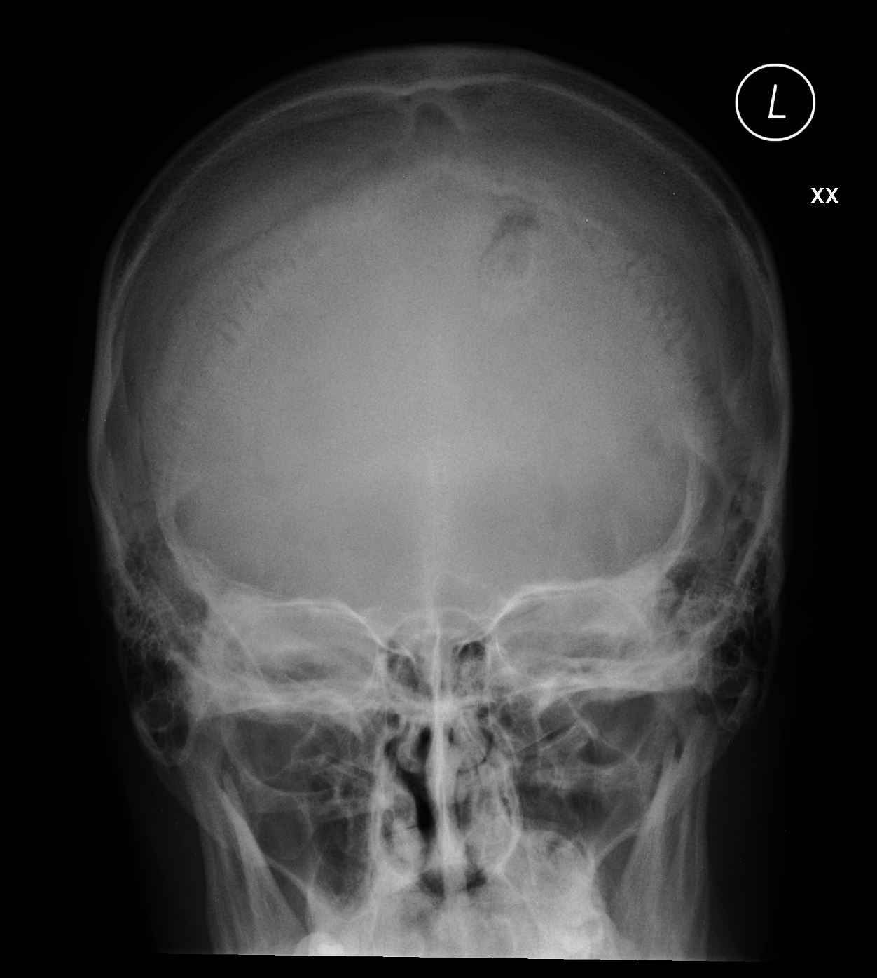Case 13